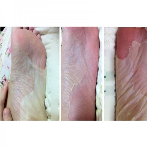 8pcs=4bag Baby Foot Peeling Exfoliating Foot Mask Sox Remove Dead Skin As Beauty Foot Care Pedicure Socks Sosu