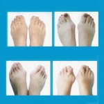 Daily Silicone Gel Foot Toe Separator & Thumb Hallux Valgus Protector&Bunion Adjuster Bicyclic Thumb Orthopedic Braces Correct