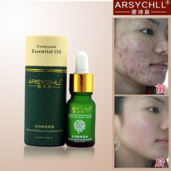 Face Care Acne Scar Removal Cream Acne Spots Skin Care Treatment Stretch Marks Whitening Remove Acne Face Essential Oil Care