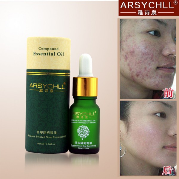 Face Care Acne Scar Removal Cream Acne Spots Skin Care Treatment Stretch Marks Whitening Remove Acne Face Essential Oil Care