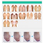 Genuine Special Hallux Valgus Pro Bicyclic Bone Thumb Orthotics Braces To Correct Daily Silicone Foot Big Toe Separator Pedicure
