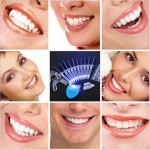 Popular White Teeth Whitening Pen Tooth Gel Whitener Bleach Remove Stains Oral Hygiene