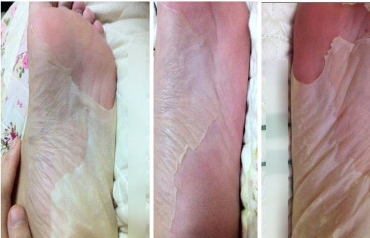 2pairs4pcs-Beauty-Remove-Dead-Skin-Foot-Mask-Skin-Smooth-Exfoliating-Mask-For-Feet-Socks-Baby-Foot-C-914761200