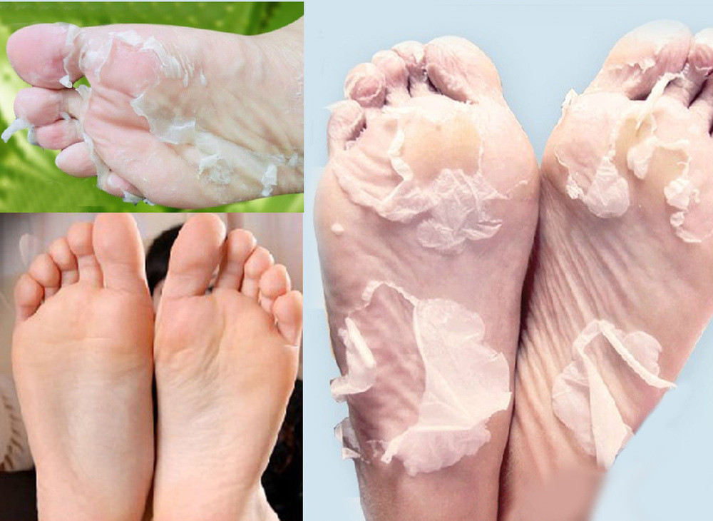 6Packs-Hot-Sale-Baby-Foot-Peeling-Mask-Exfoliating-Socks-For-Pedicure-Sosu-Exfoliating-Foot-Care-Dea-32426491961