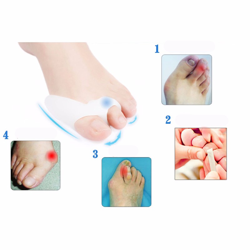 Daily-Silicone-Gel-Foot-Toe-Separator-amp-Thumb-Hallux-Valgus-ProtectorampBunion-Adjuster-Bicyclic-T-1830783511