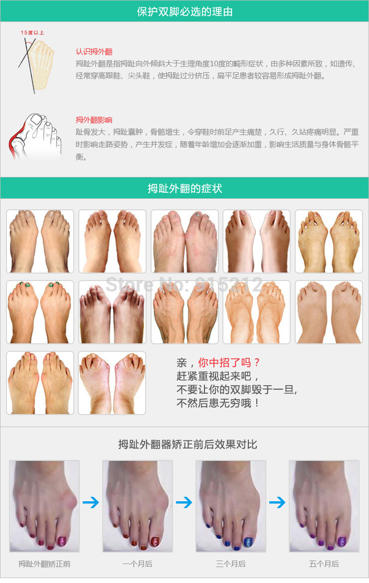 Daily-Silicone-Gel-Foot-Toe-Separator-amp-Thumb-Hallux-Valgus-ProtectorampBunion-Adjuster-Bicyclic-T-1830783511