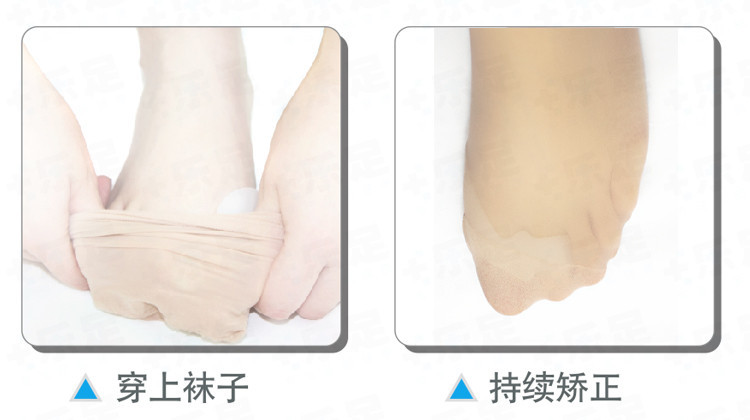 Genuine-Special-Hallux-Valgus-Pro-Bicyclic-Bone-Thumb-Orthotics-Braces-To-Correct-Daily-Silicone-Foo-1869715242