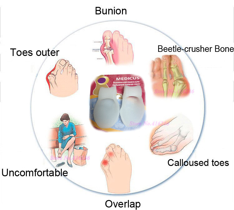 Silicone-Gel-Bunion-Big-Toe-Separator-Spreader-Eases-Foot-Pain-Foot-Hallux-Valgus-Correction-Guard-C-1871460780