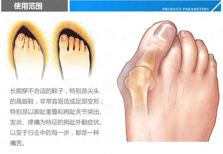 Silicone-Gel-Bunion-Big-Toe-Separator-Spreader-Eases-Foot-Pain-Foot-Hallux-Valgus-Correction-Guard-C-1871460780